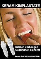 Algopix Similar Product 18 - Keramikimplantate Risiken vorbeugen