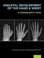 Algopix Similar Product 6 - Skeletal Development of the Hand and