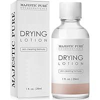 Algopix Similar Product 17 - Majestic Pure Acne Drying Lotion Acne