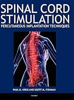 Algopix Similar Product 18 - Spinal Cord Stimulation Percutaneous